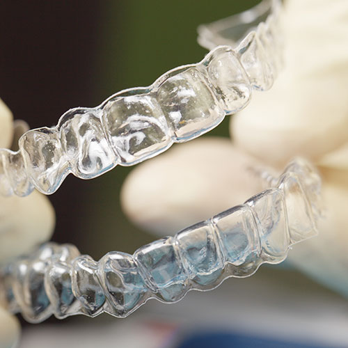 clear aligners mt gravatt